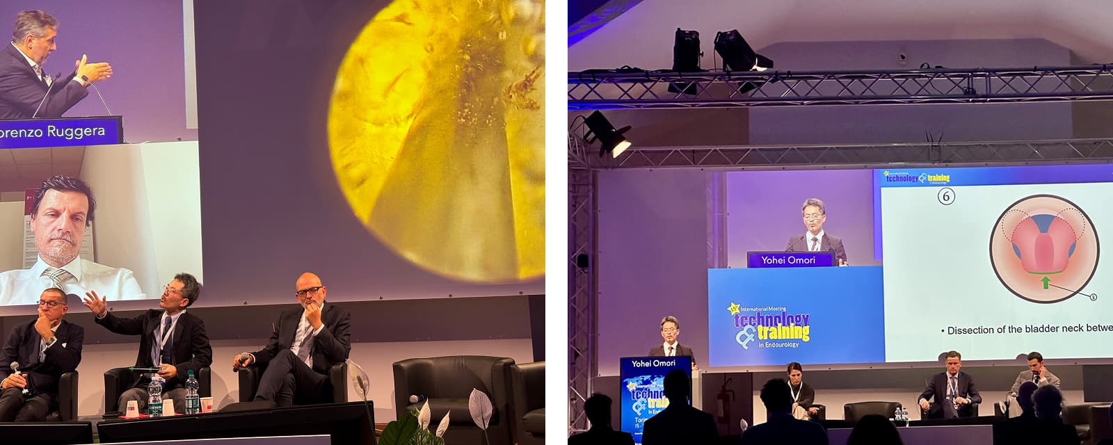 TNT （Technology and Training in Endourology)meetingでの講演の様子